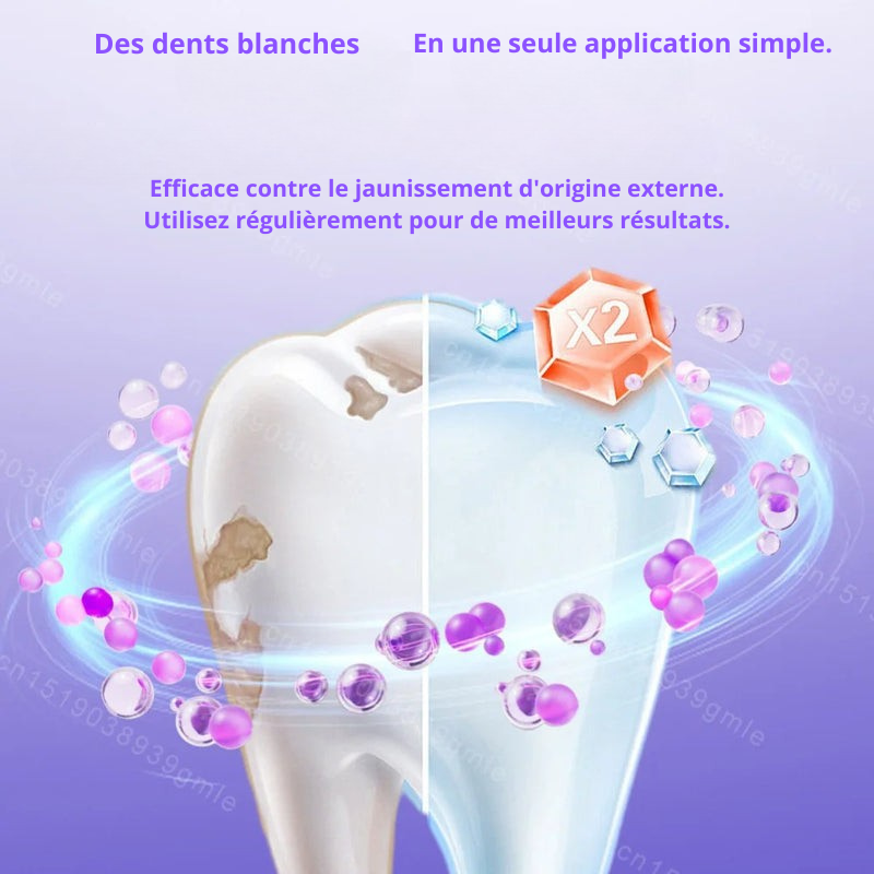 Bandelettes Blanchissantes Violettes – Sourire Éclatant en 30 Minutes | Émail Préservé