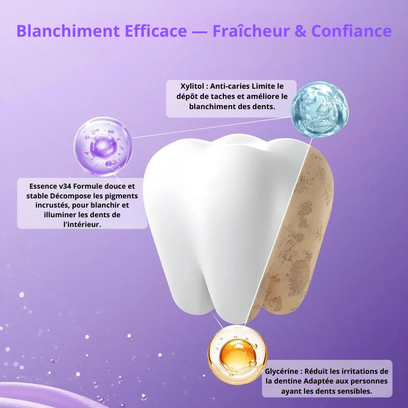 Bandelettes Blanchissantes Violettes – Sourire Éclatant en 30 Minutes | Émail Préservé