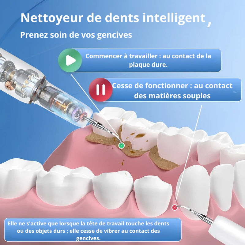 Détartreur Dentaire Ultrasonique Anti-Taches