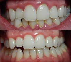 Customer testimonial 4